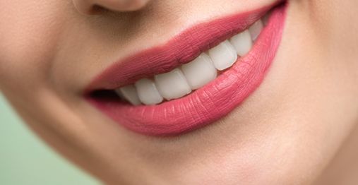 A Comprehensive Guide to Teeth Whitening with Fillings