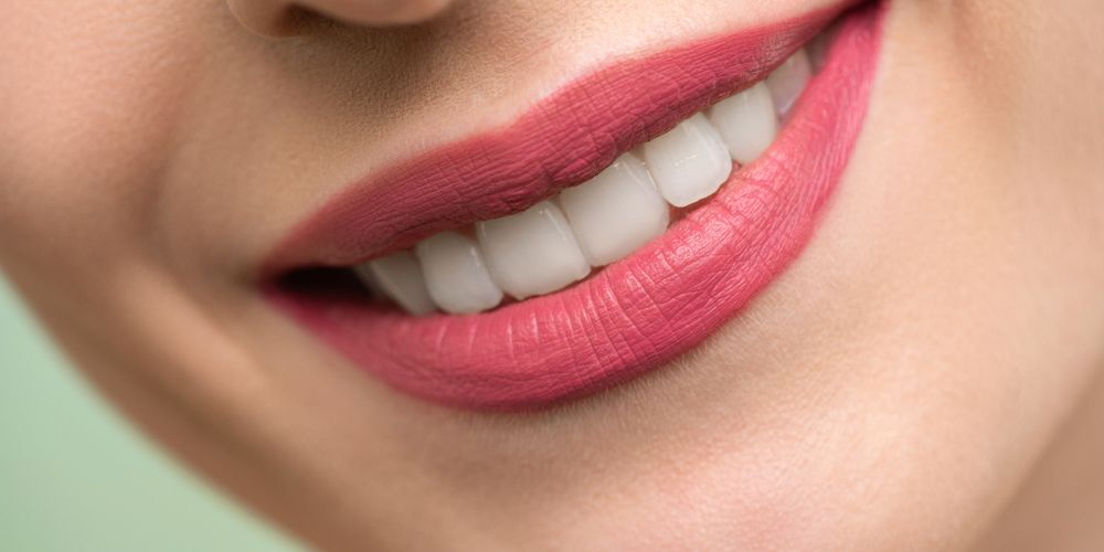 A Comprehensive Guide to Teeth Whitening with Fillings