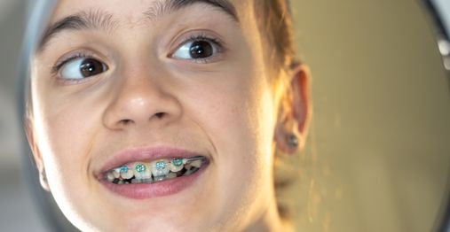 Can You Wear Wax on Braces While Sleeping?