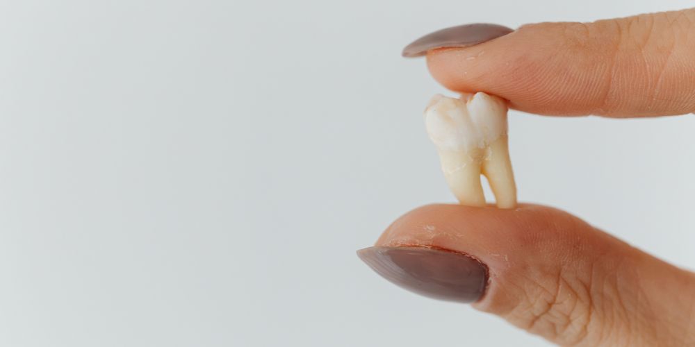 Loose Tooth Causes and Treatment in Adults