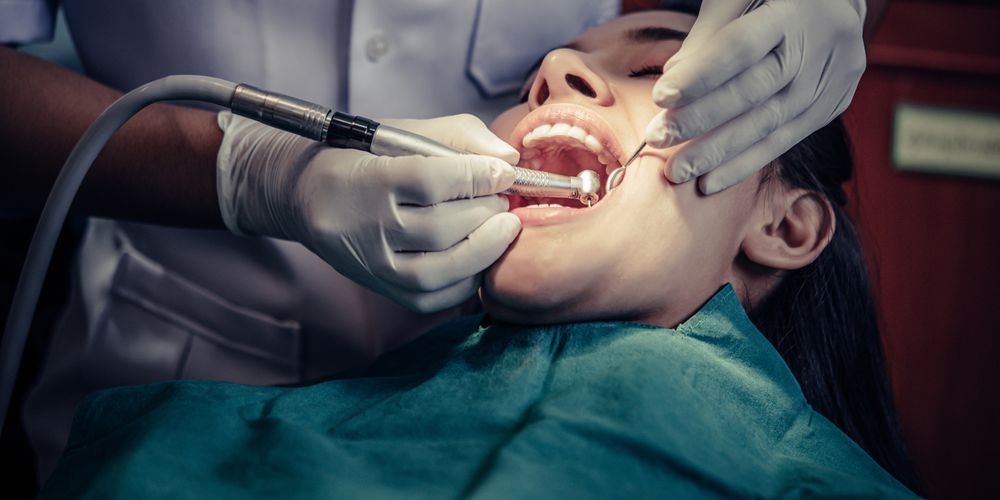 The Ultimate Guide to Dental Cavities